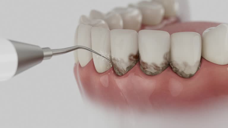 Trusted Teeth Cleaning And Checkup service in Chester, SC - Dentist Open Now